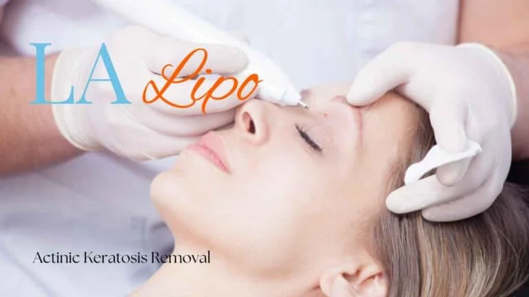 Woman receiving Actinic Keratosis Removal Treatment Didcot