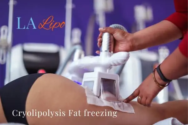 women getting fat freezing Didcot
