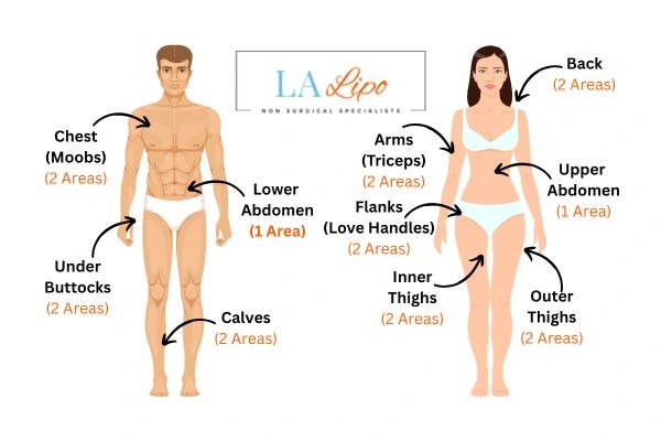 LA LIPO Cryolipolysis Areas Didcot