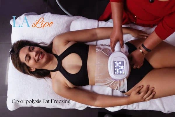 woman getting cryolipolysis Didcot