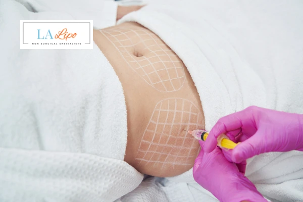 aqualyx fat dissolving injections Didcot