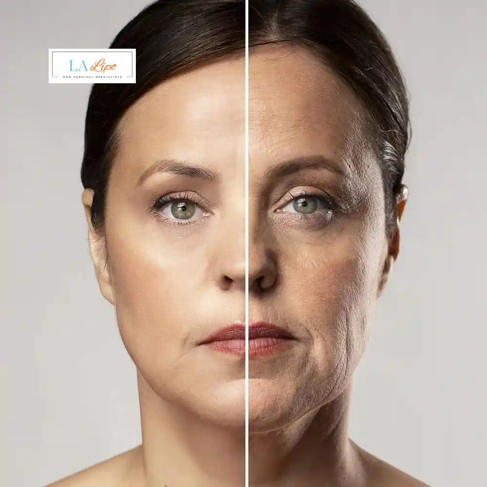 How Can You Tell If Non-Surgical Skin Tightening Is Right for You Didcot?