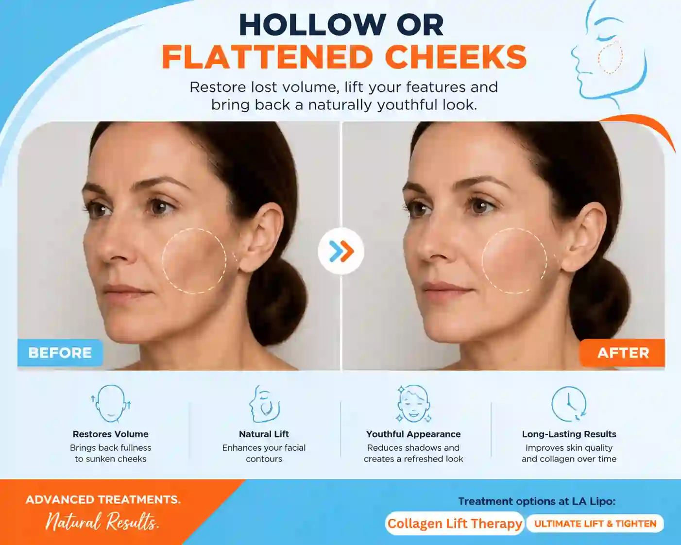 Sign #4: Hollow or Flattened Cheeks Didcot