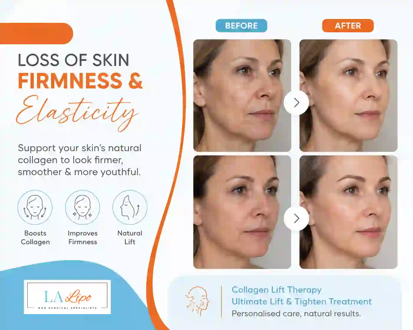 Sign #7: Loss of Skin Firmness and Elasticity Didcot